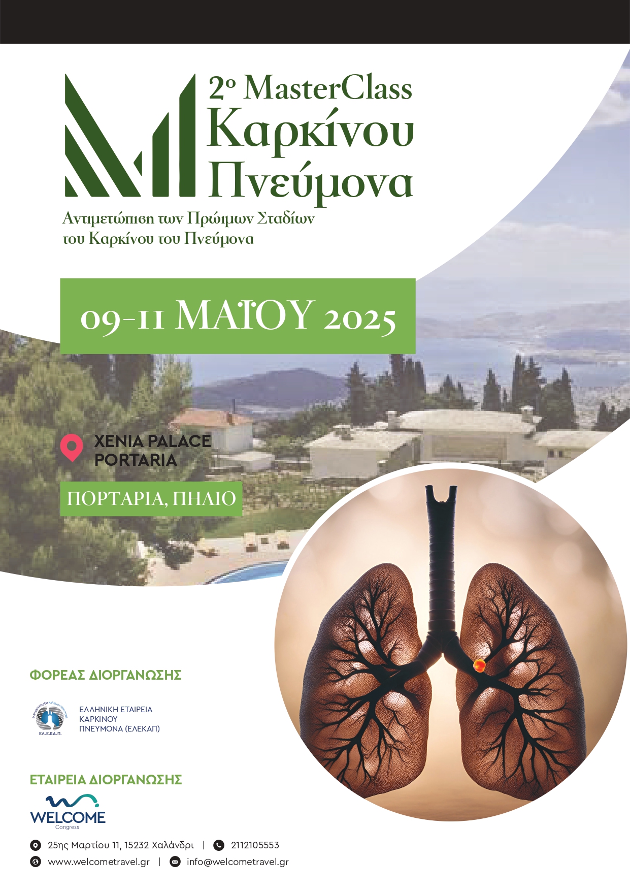 2o MasterClass Καρκίνου του Πνεύμονα